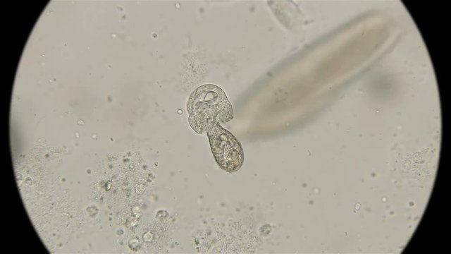 infusoria Coleps, class Ciliata, tear apart organic remains of a dead infusoria, scavengers of the micro world, under a microscope