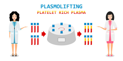 Platelet rich plasma. PRP method. Vector.