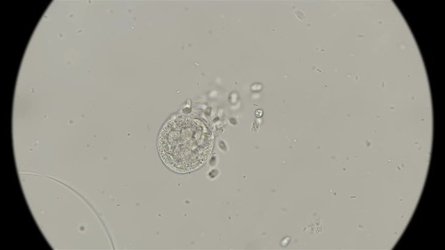 a colony of small ciliates attacked Vorticella which, without movement, under the microscope