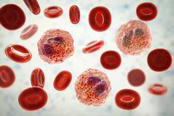 Eosinophilia, blood smear showing multiple eosinophils surround by red blood cells, 3D illustration. Eosinophilia occurs in parasitic and fungal infections, allergies, autoimmune disorders, tumors