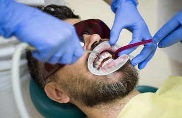 Bearded man having teeth examined at dentists. Close up of men patient with beard with open mouth...