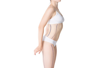 Liposuction, fat and cellulite removal concept, overweight female body with painted lines and arrows
