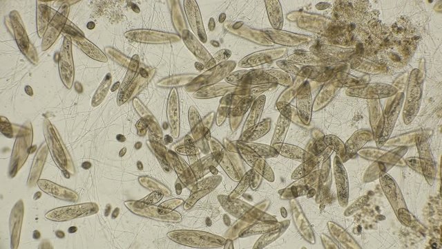 big colony Infusorium Param&eacute;cium caud&aacute;tum in motion, under a microscope