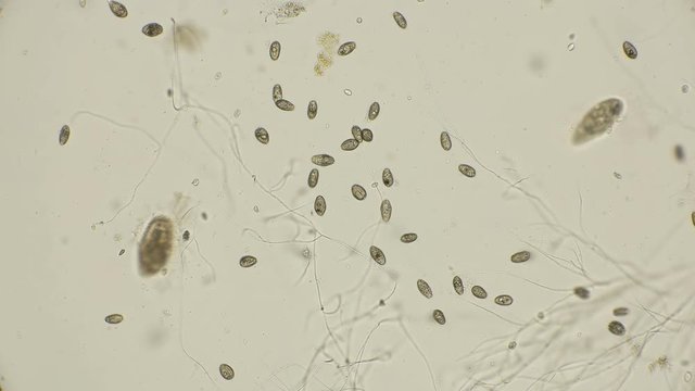 dead colony of the ciliates of the coleps, which are largely in dirty water, after being treated with a microbial agent, under a microscope