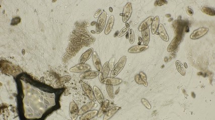colony Infusorium Paramécium caudátum dies when the anti-microbial drug is injected into the water, under the microscope, Timelapse