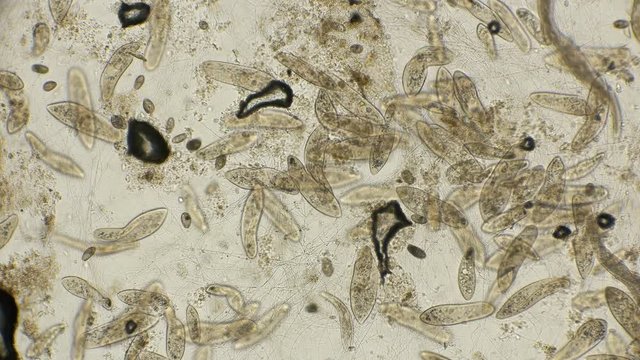 big colony Infusorium Param&eacute;cium caud&aacute;tum in motion, under a microscope