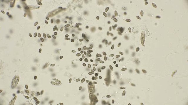 a large colony of ciliates Coleps, which are largely located in dirty water under a microscope