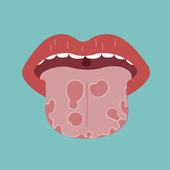Tongue disease, vector of organ concept.