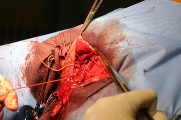 Surgical intervention by perineal hernia by dog (hernia involving the perineum) - obrazy, fototapety, plakaty