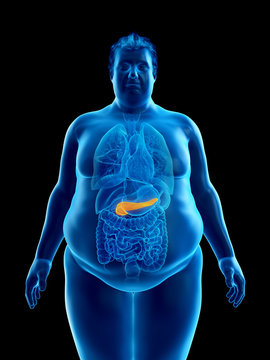 3d rendered medically accurate illustration of an obese mans pancreas