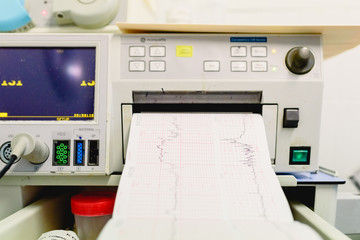 Valencia, Spain - October 25, 2018: Graphic with electrocardiogram of a pregnant woman during a hospital examination.