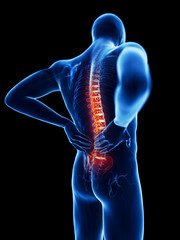3d rendered illustration of a man having backache