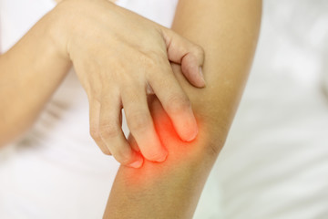 Woman itch hand arm and scratch and have problem with skin,Skincare Concept