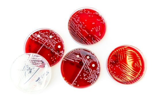 Bacteria colonies in Petri Dishes