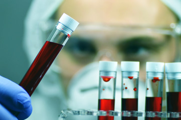 Blood laboratory tests