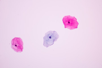 Normal squamous epithelial cells of cervical woman on white background view in...