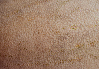 melon rind texture