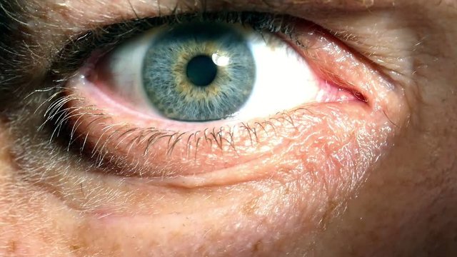 Closeup of pulsating Iris showing pupillary response