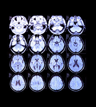 Radiograph Neuroimaging of Brain - Head Medical Monitoring - Xray, MRI, CT Diagnostic Scan Background
