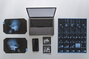 overhead view of laptop phone magnetic resonance imaging results