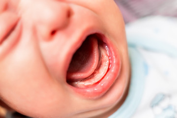 Close up photo of crying 3 months old baby mouth. Bare gums without teeth.