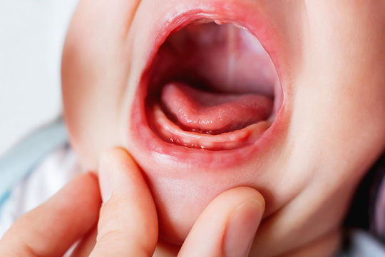 Close up photo of crying 3 months old baby mouth. Bare gums without teeth.