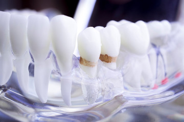 Fototapeta na wymiar Dentist dental teeth model