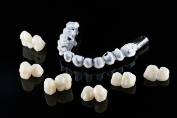 titanium beam and manufactured high-quality crowns, all set for an all-out operation