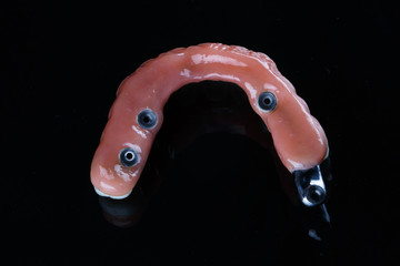top view of the prosthesis, the lower jaw