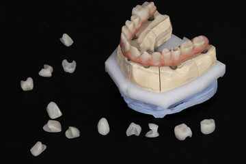 complete Dental kit for total work, ceramic crowns and the basis for inserts