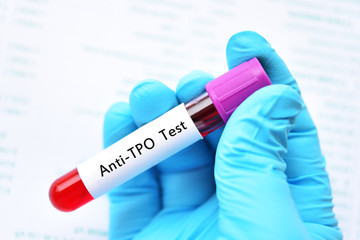 Blood sample tube for anti-TPO or anti-thyroid peroxidase test, diagnosis for thyroid hormone...