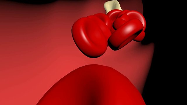 Animation of the formation of thrombosis