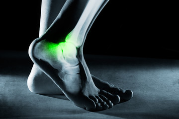 Human foot ankle and leg in x-ray, on gray background. The foot ankle is highlighted by green...