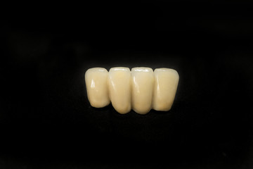 dental crown and bridge of lower incisor teeth on black background