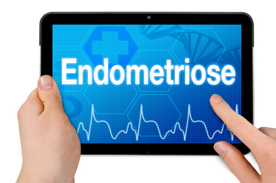 Endometriose Unterleibs-Erkrankung