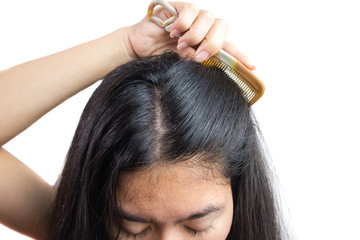 Fototapeta premium women head with dandruff Caused by the problem of dirty. Or caused by skin disease or Seborrheic Dermatitis. It has white scaly and it will cause itch. Product Concepts Scalp Care and Hair Care.