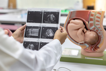 Ultrasound of baby in pregnant woman, Doctor reading test results of pregnant woman by ultrasound.