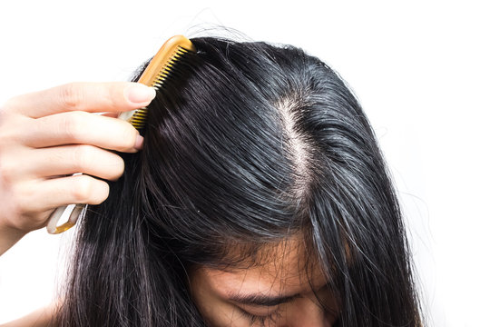 Greasy Hair Images – Browse 6,348 Stock Photos, Vectors, And Video | Adobe  Stock