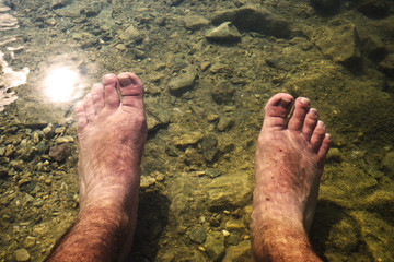 Bathing feet in healing water