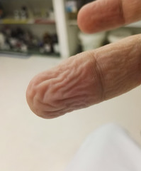 Anatomy of the body: finger of a human hand wrinkled by water - wet finger, wrinkly finger - with fingerprint detail