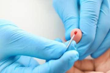 Doctor using lancet to get blood sample for test, closeup