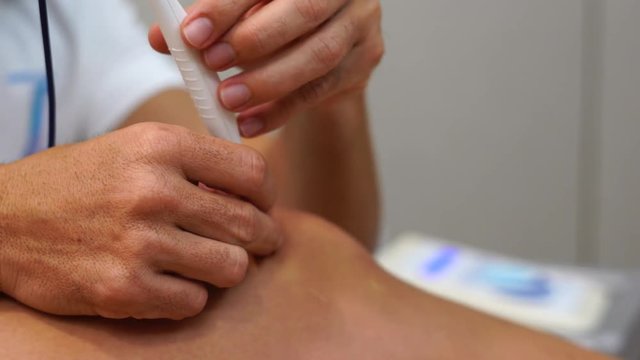 Ultrasound assisted ecography intratissue percutaneous electrolysis dry needling physical therapy rehabilitation physiotherapist treatment machine in hospital medical center IPE physiotherapy clinic.