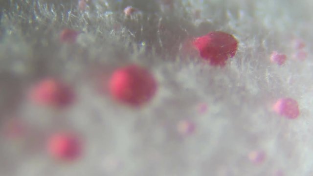 Mold taken from rotten currant , under a microscope. Colony of mold with spores on a berry  jam. Allergy, poisoning, fungus. Abstract texture of a white mold colony. Close up. Closeup.4K  UHD