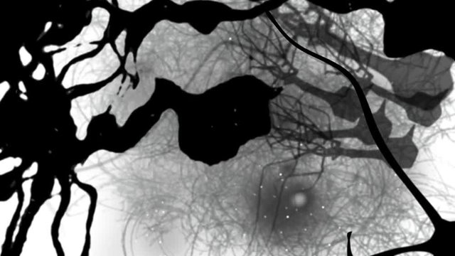 Stylized depiction: Neurons in the brain begin to collapse