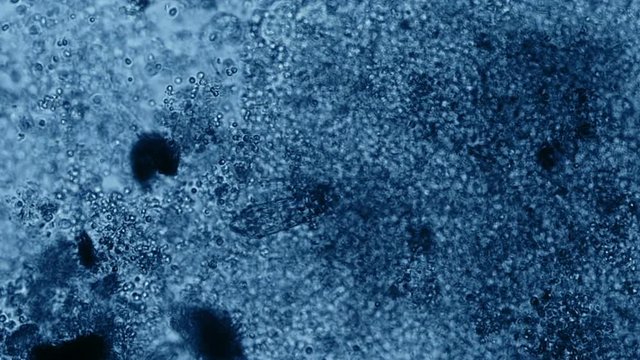 Protozoa Rotifer Feeding Microscope Blue Filter 200x