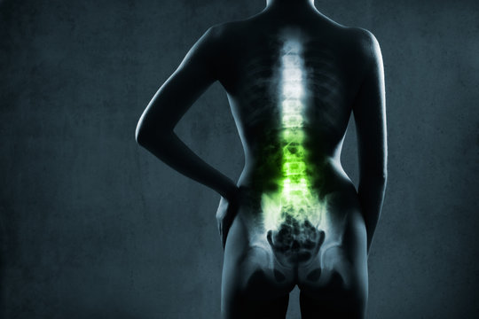Human spine in x-ray, on gray background. The lumbar spine is highlighted by green colour.