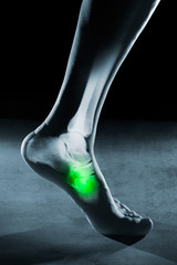 Human foot ankle and leg in x-ray, on gray background. The foot ankle is highlighted by green...