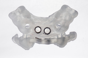 The classic pattern Dental implants for two, shot with a reflection on a white background