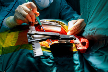 The surgeon makes an operation surgeon in operation room with blood mask