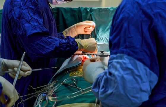 Surgeon with surgical instrument during the open heart operation